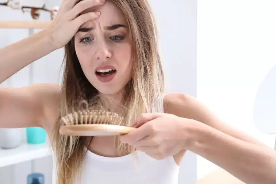 About Hair Loss