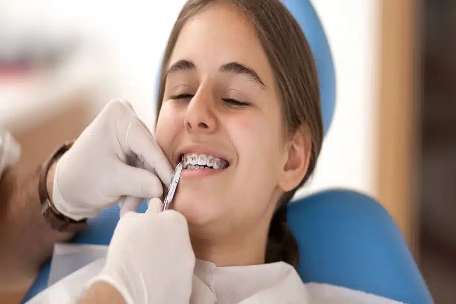 Orthodontic Treatment