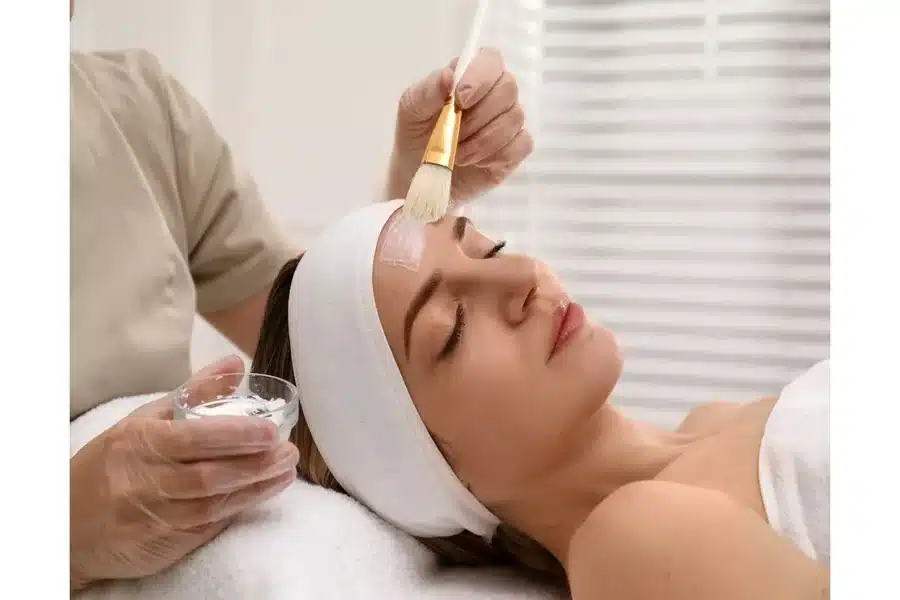 Chemical Peel