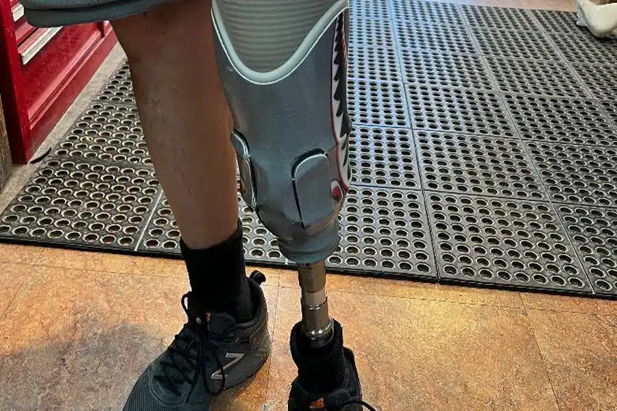Custom Prosthetic