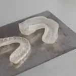 Mouthguard